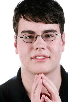 acne therapy with bentonite clay